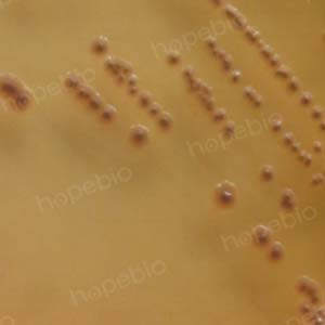 大肠埃希菌培养,大肠埃希菌70%正常吗