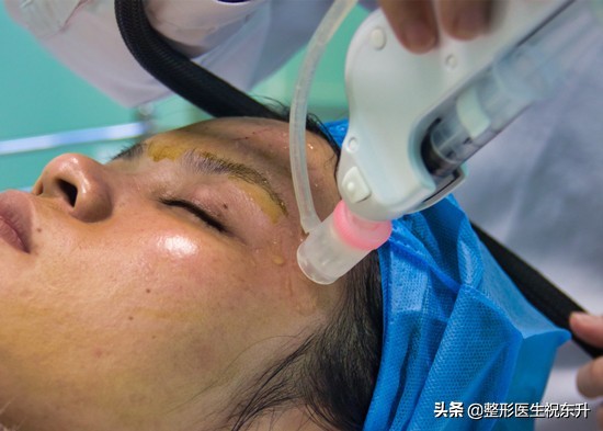 听医生讲养生,水光针为您祛除肤质困扰