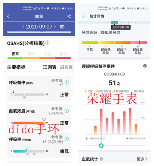 心率血压监测智能手环哪个牌子好,市面上哪款监测血压手环比较好