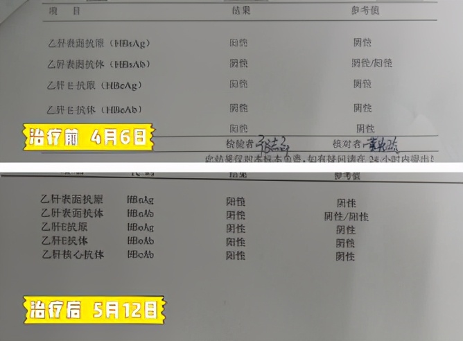 乙肝有康复的案例吗,乙肝康复案例