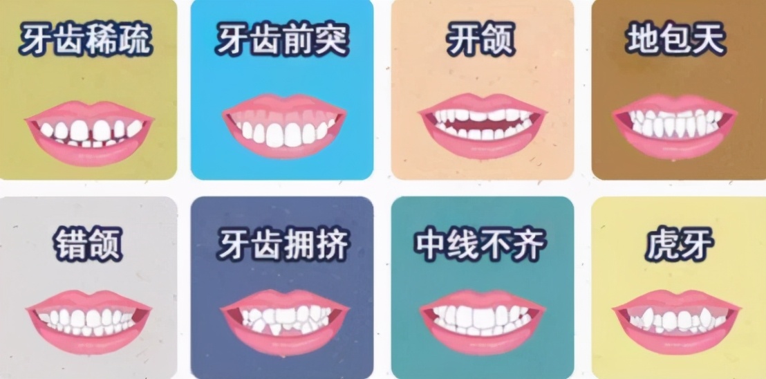 十八岁是矫正牙齿好还是烤瓷牙好,牙齿中线不齐能通过烤瓷牙修复吗