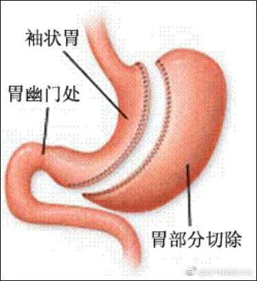 网红泡泡龙不幸猝死,网红泡泡龙于海龙去世