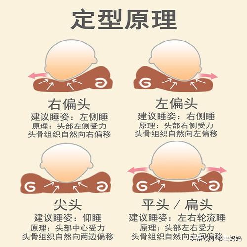 医院给宝宝调整头型,三种方法帮助宝宝塑造漂亮的头型