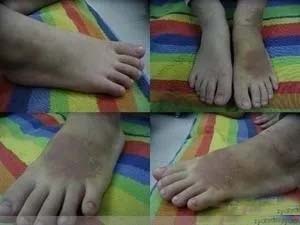 正红花油有麝香成分吗,正红花油有化学品吗