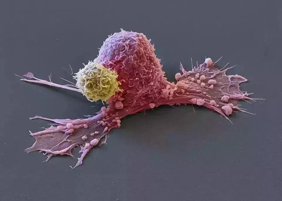 她拥有永生，靠此造福10亿人，死于癌症后，她的细胞带她重生！