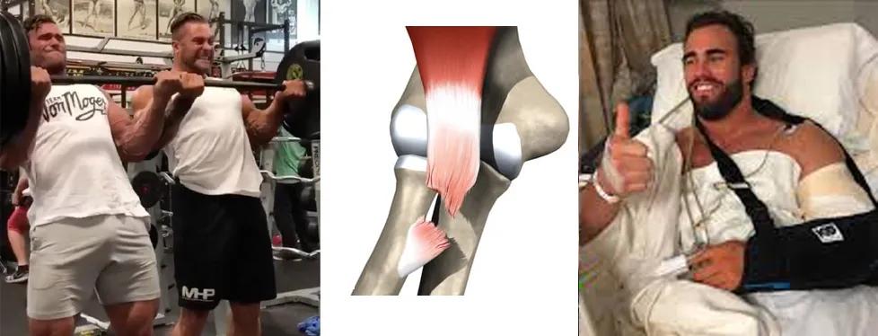 健身过度：当这种症状缠上你时，另外几种也离你不远了