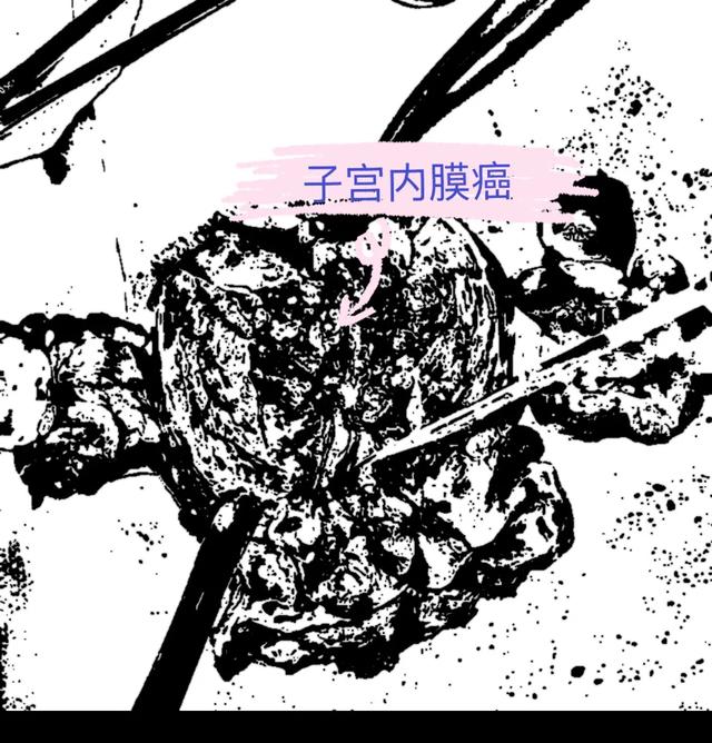 大姨妈绝经三四年突然又来了,绝经后又来月经是回春吗