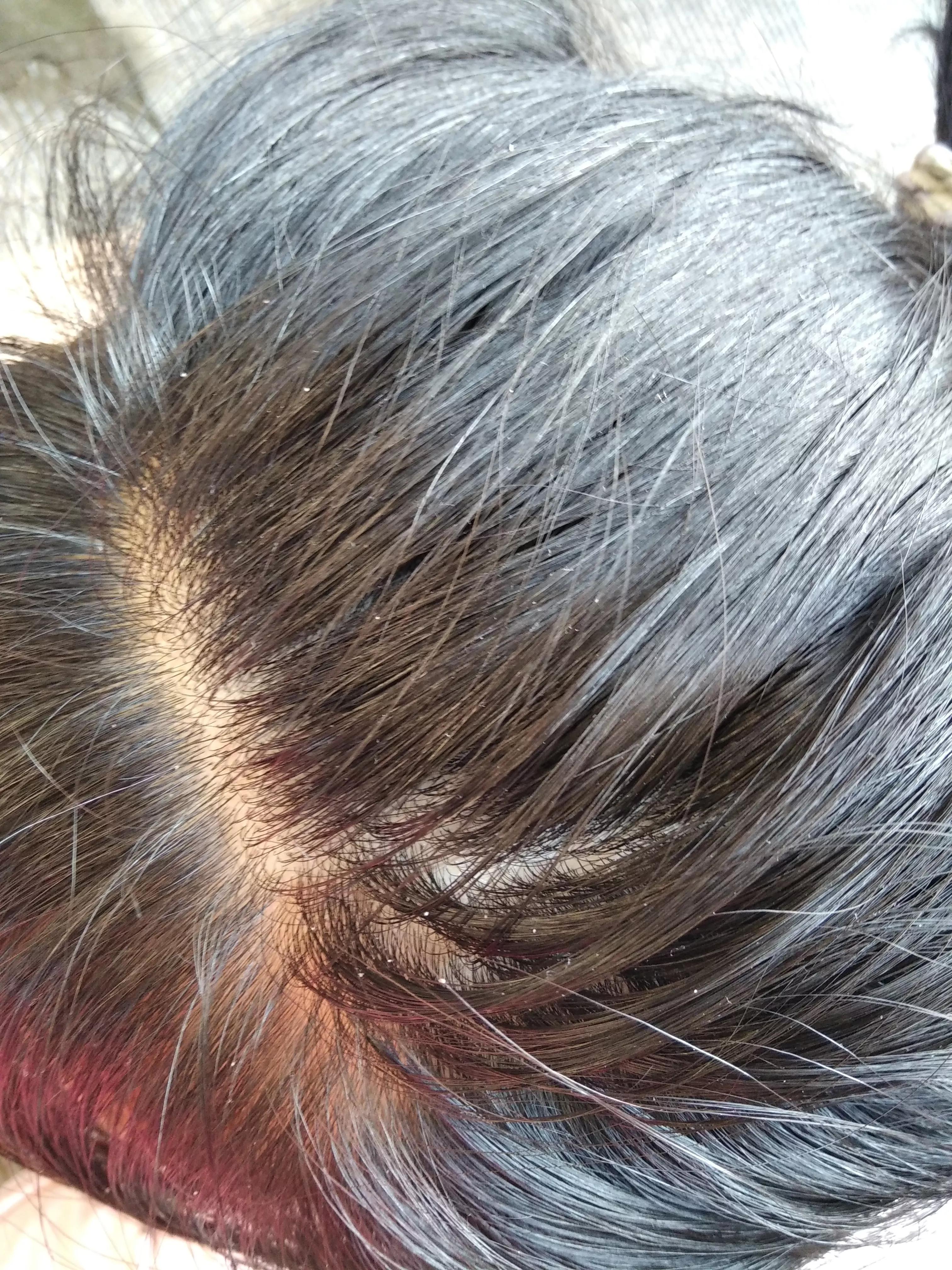 啤酒驱虫小妙招,啤酒洗头去白发