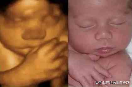 做四维彩超能看到胎儿图片吗,四维彩超图片就是胎儿的样子吗