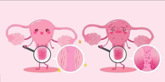 子宫有疼痛感是不是子宫癌,三处痛可能是癌症