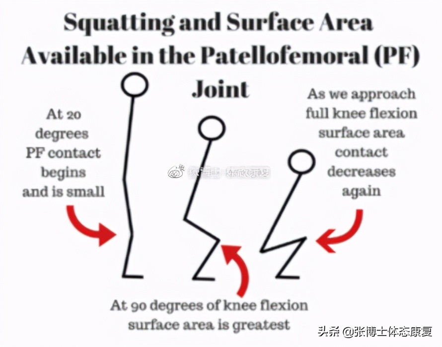 运动康复膝关节疼痛解决,下髌骨关节疼痛综合征