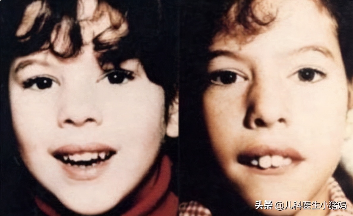 这4种习惯不注意孩子真的会变丑,基因决定孩子长相丑怎么办