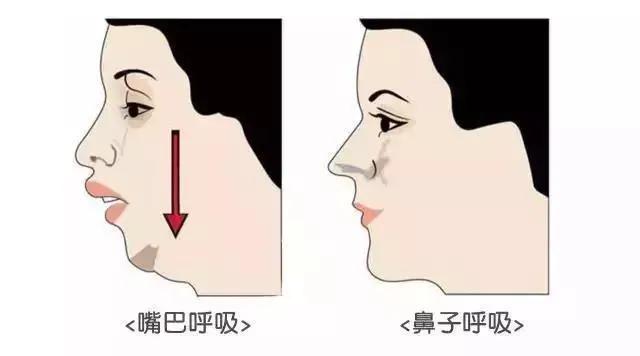 侧颜很难看是因为什么,侧颜不好看怎么修