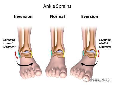 刚崴脚是要冷敷还是热敷,崴脚后24小时内是热敷还是冷敷