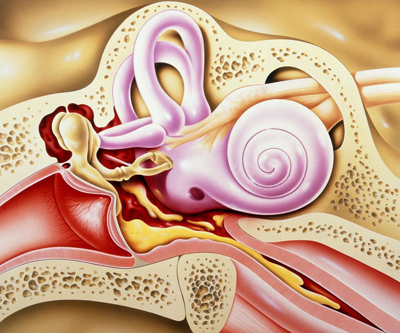 中耳炎迁延不愈,一家人反反复复得中耳炎