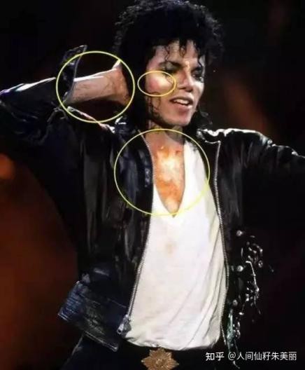 脸上有斑用什么护肤品祛斑效果好,40岁女人脸上长斑怎样有效祛斑