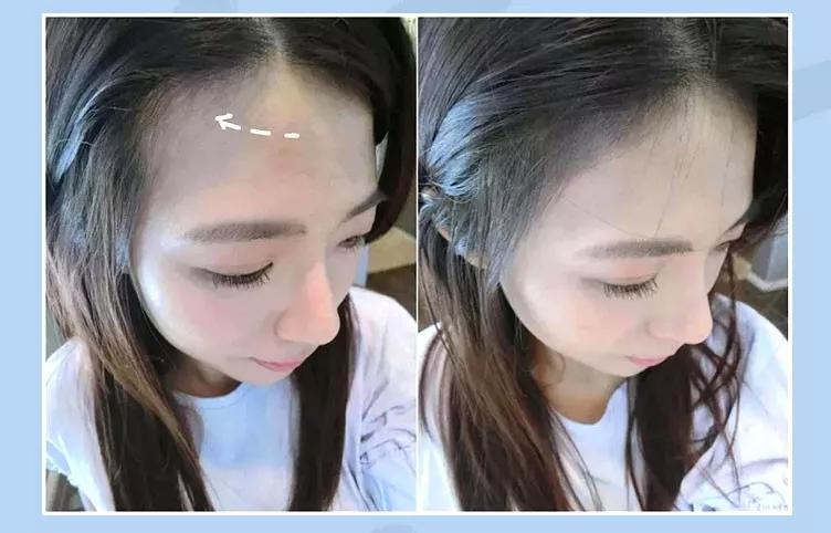 天天散着头发容易脱发吗,头发油了特别容易脱发