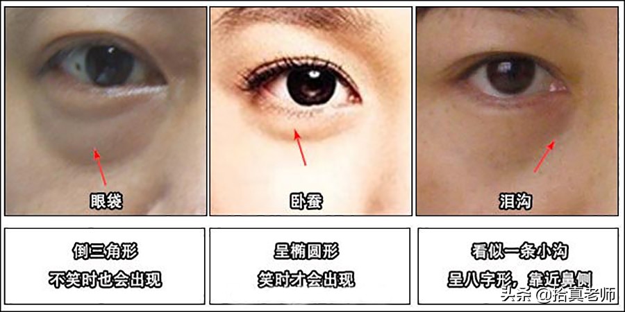 你不知道的真实的秘密,你不知道的秘密黑眼圈