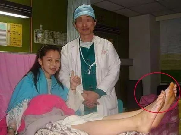 脚趾超级痛,轻度脚趾外翻如何矫正