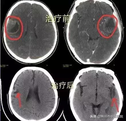 死神推我走陀螺拖我回