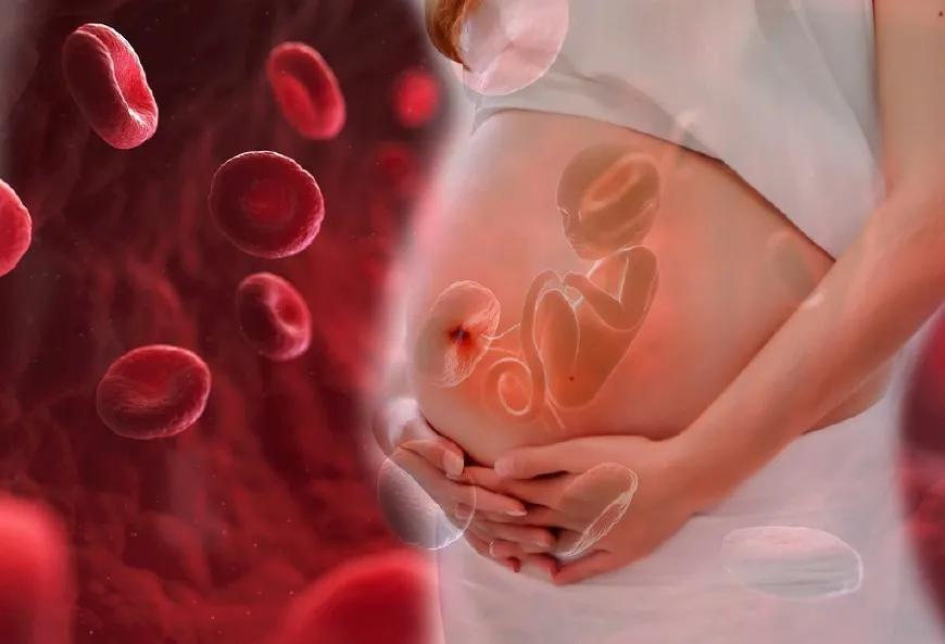 妊娠缺铁性贫血的并发症,婴儿严重贫血有生命危险吗