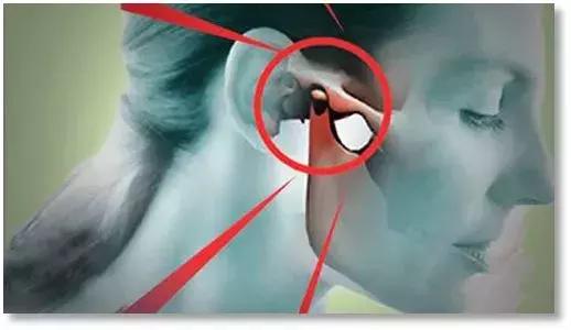 颞下颌关节紊乱口腔内壁会痛吗,张大嘴巴会咯吱咯吱响