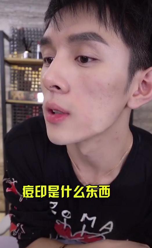 毛戈平粉膏痘坑肌上妆效果,毛戈平粉膏瑕疵皮真实测评