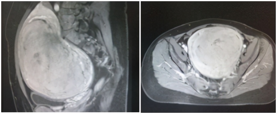 海扶刀的缺点是什么,海扶刀背后的真相视频