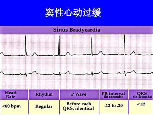 显著窦性心动过缓怎么治疗和调养,体检发现窦性心动过速该怎么办