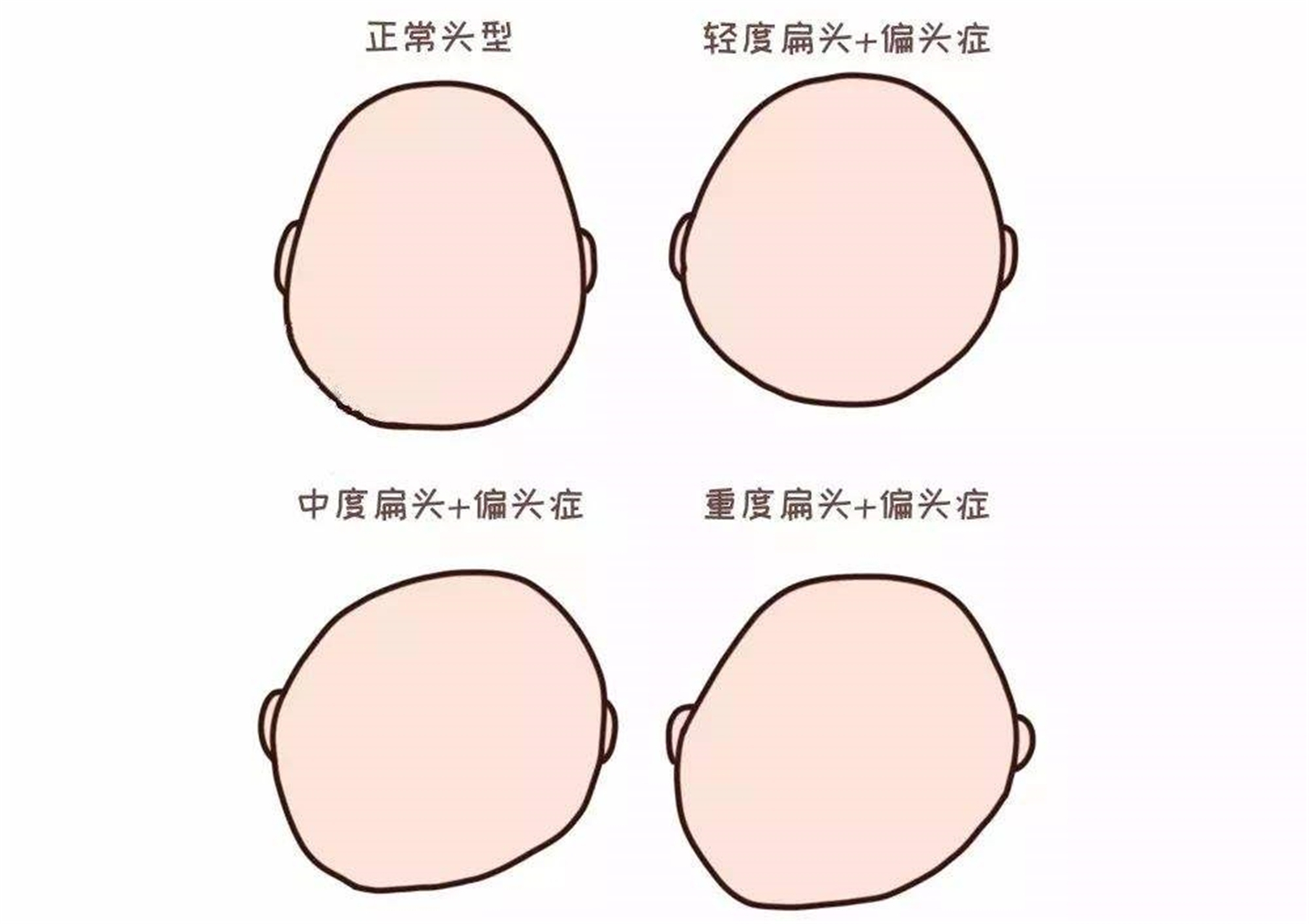 给宝宝睡定型枕,给宝宝买枕头有必要吗
