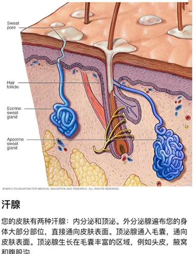 多汗症是怎么回事？如何保健？