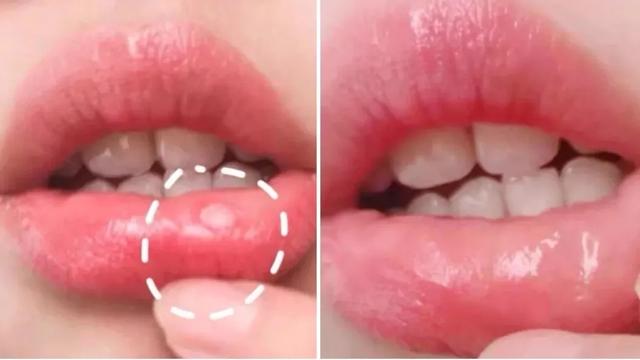 刷牙怎么刷能立刻从黄牙变成白牙,刷牙白牙小妙招