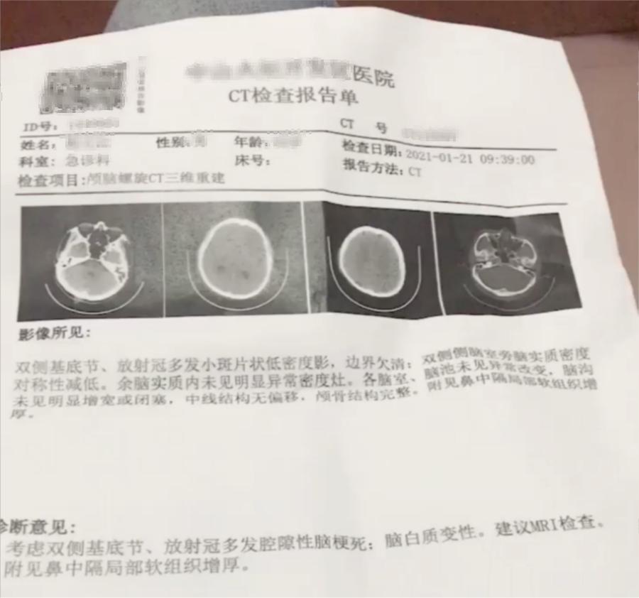 父亲中风后意志很消沉,中风康复训练经验