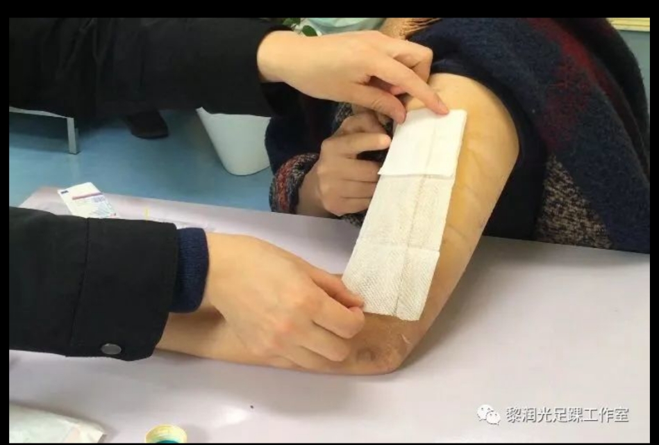 术后自己在家换药应该注意什么,医院手术后换药流程