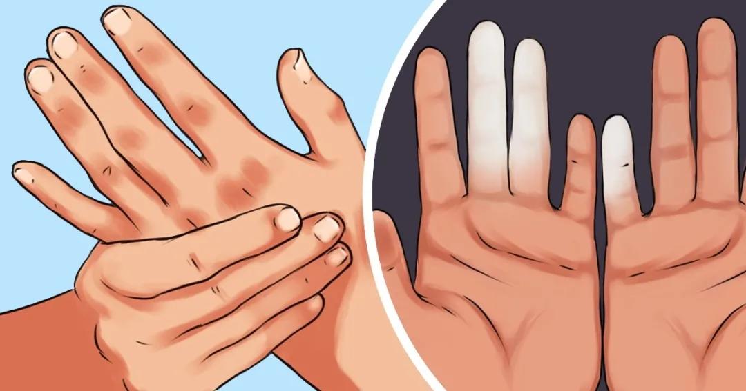 双手麻木怎么办及时检查找到原因,双手发麻做什么检查