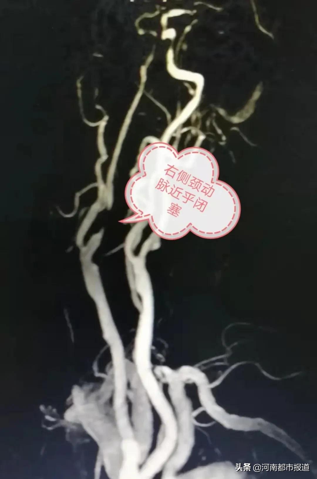 一年晕倒两次怎么恢复,一年内晕倒3次是什么原因