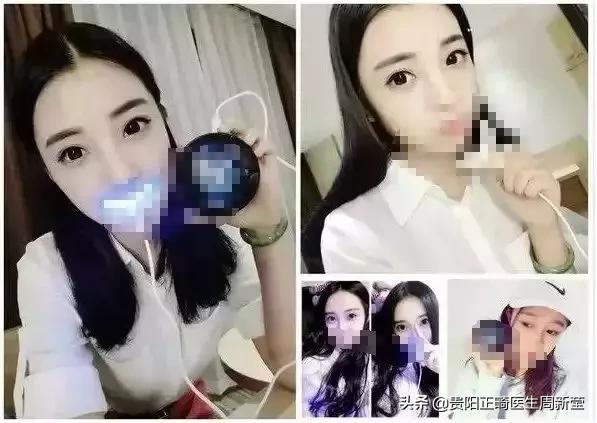 市面上冷光美牙仪真的有用吗,蓝光美白牙仪真的管用吗