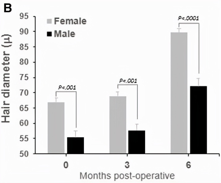 干细胞治疗秃头最新消息,干细胞治秃头
