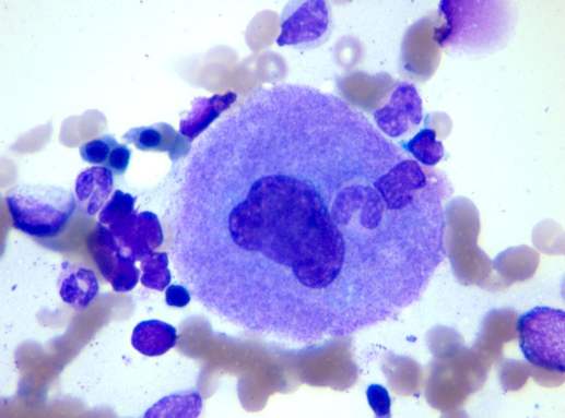 得了痔疮怎么办学会三招治痔疮,得了痔疮别担心这个小方法快试试