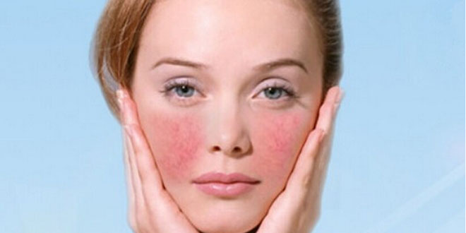 化妆品过敏怎么才能抗敏,化妆品过敏了怎么办最快最有效