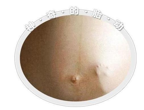 胎动为什么有时候感觉到痛,胎动异常需要立即去医院么