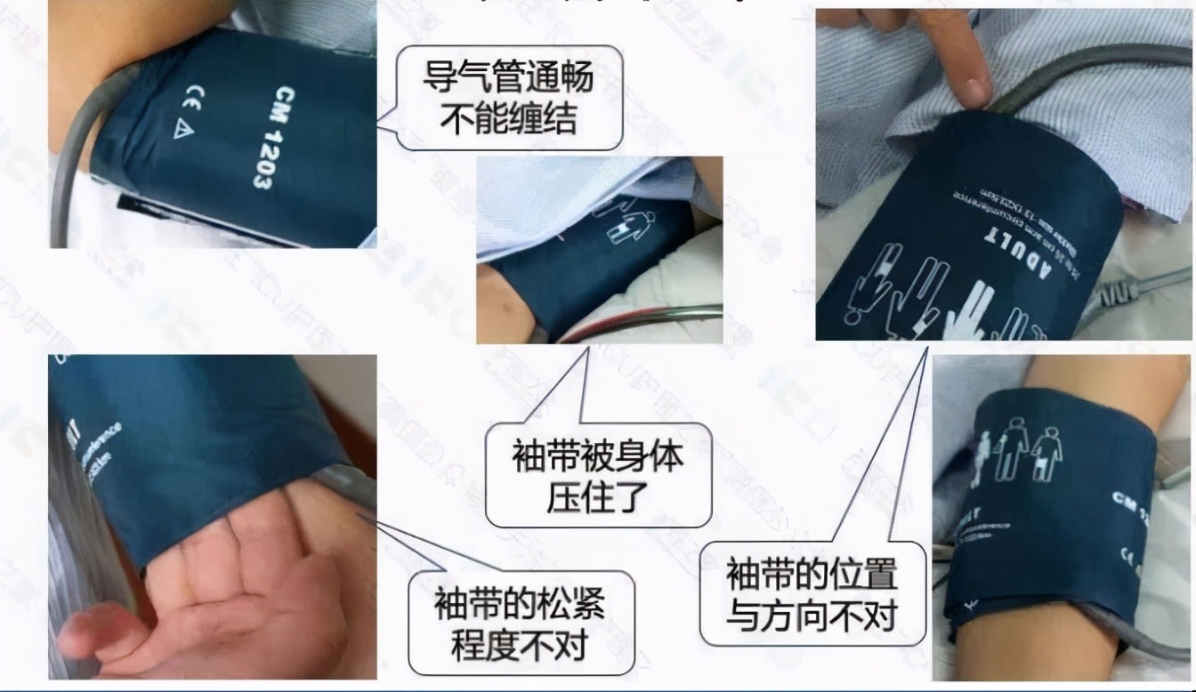 心电监护使用的收费标准,心电监护使用年限