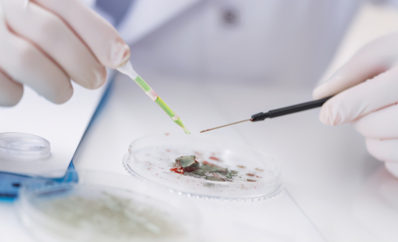 广药三院肿瘤二科｜27岁女孩，查出宫颈癌，连续交往多个男友