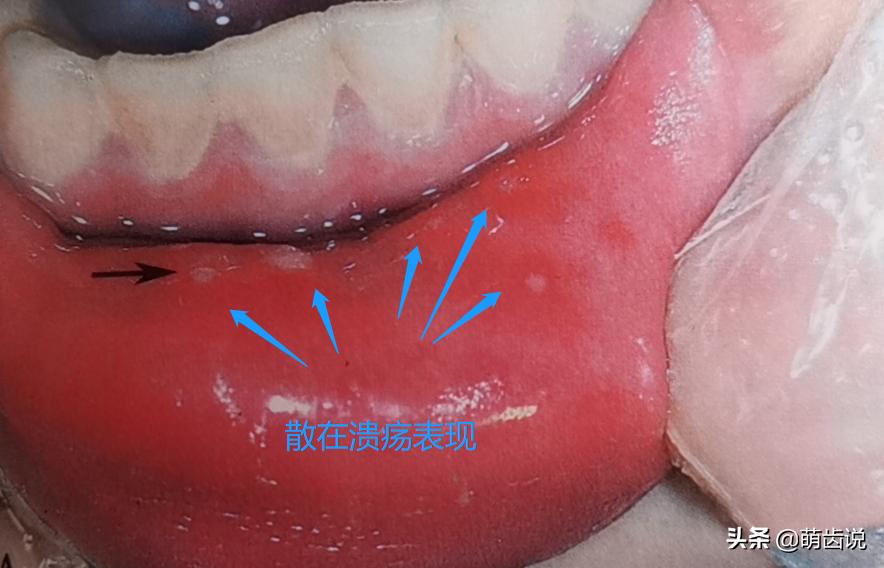 宝宝喊牙疼上嘴唇肿了是什么原因,宝宝牙疼为什么晚上疼得厉害