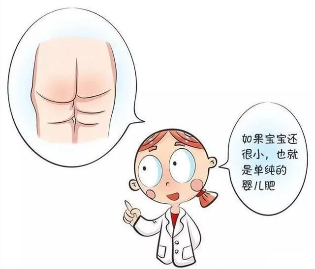 宝宝两边腿纹印不一样深,宝宝两侧腿纹不一致是什么原因