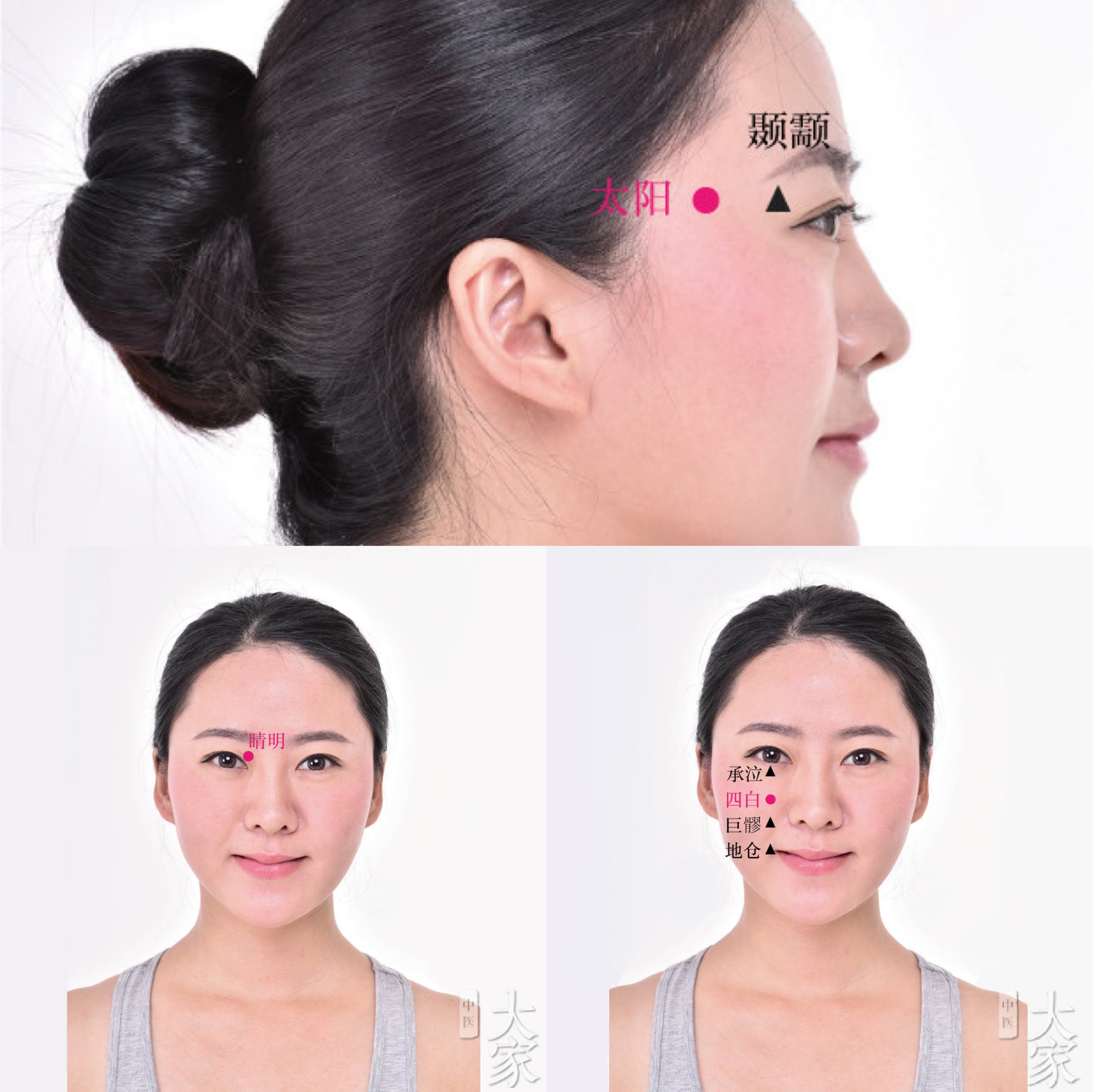 打耳洞可以预防近视,打耳洞可以预防近视吗