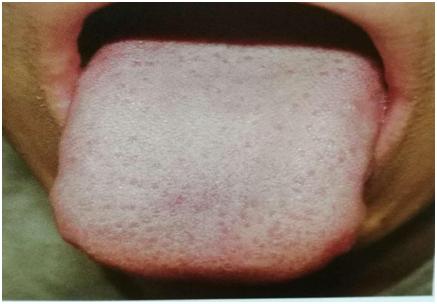 中医经典舌诊和中医全息舌诊区别,中医舌诊知识大全图片