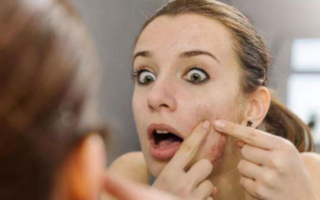 长痘怎么补充蛋白质,长淋巴痘应该补充什么维生素