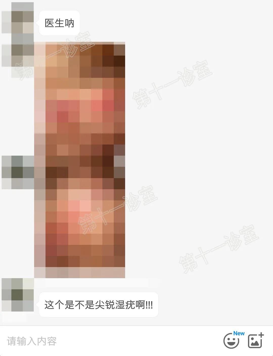 尖锐性湿疣与假性湿疣最大的区别,假性湿疣和尖锐性湿疣对比