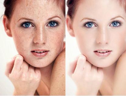 叙美雅肤护品,叙美雅美容皮肤管理